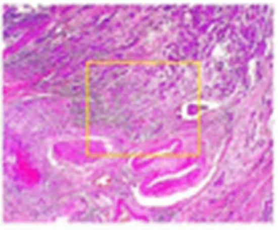 Class-Specific Data Augmentation Bridging the Imbalance in Multiclass Breast Cancer Classification